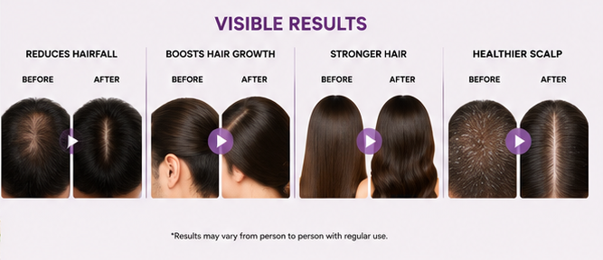 Intra Shine Lite Hair Serum | Hair & Scalp Nourishing | Lightweight Non-Sticky | Men & Women | 30ml