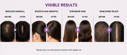 Intra Shine Lite Hair Serum | Hair & Scalp Nourishing | Lightweight Non-Sticky | Men & Women | 30ml