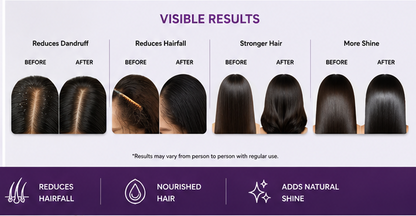 Intra Shine Hair Serum | Scalp Care & Hair Nourishing | Lightweight Non-Sticky | Men & Women | 50ml