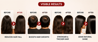Intra Shine Red Onion Hair Oil with Comb Applicator | Nourishing Scalp Care | Non-Sticky | Men & Women | 100ml