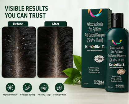 Ketodila Z Anti-Dandruff Shampoo | Ketoconazole & Zinc Pyrithione Formula - 100ml