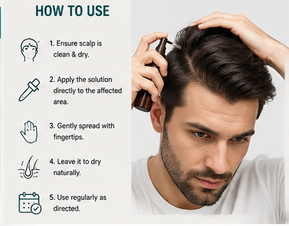 Stonark-F10 Minoxidil 10% & Finasteride Topical Solution - 60 Ml