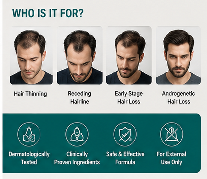 Stonark-F10 Minoxidil 10% & Finasteride Topical Solution - 60 Ml