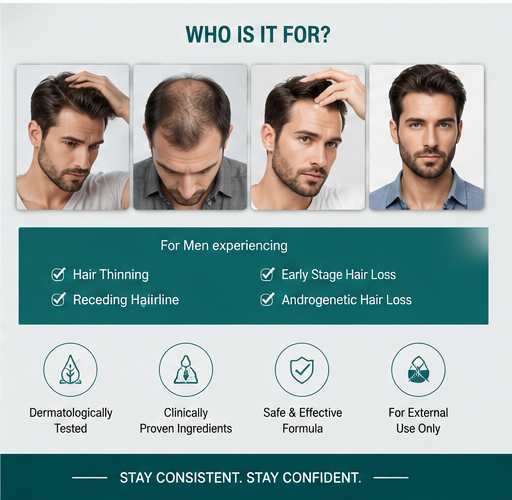 Stonark-F Minoxidil 5% & Finasteride Topical Solution - 60 Ml